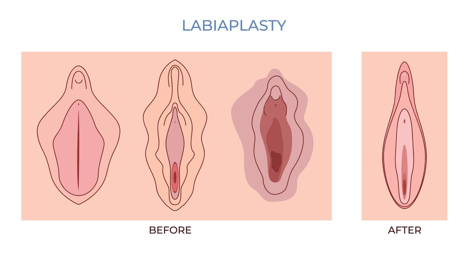 Jinsiy aloqa uchun Jorjiyadagi qizlar